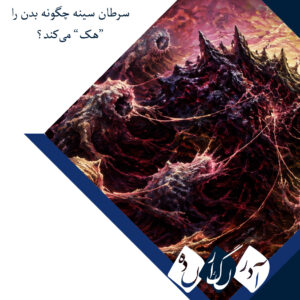 فریبکاری سرطان سینه: تومورها چگونه اعصاب بدن را به خدمت می‌گیرند؟